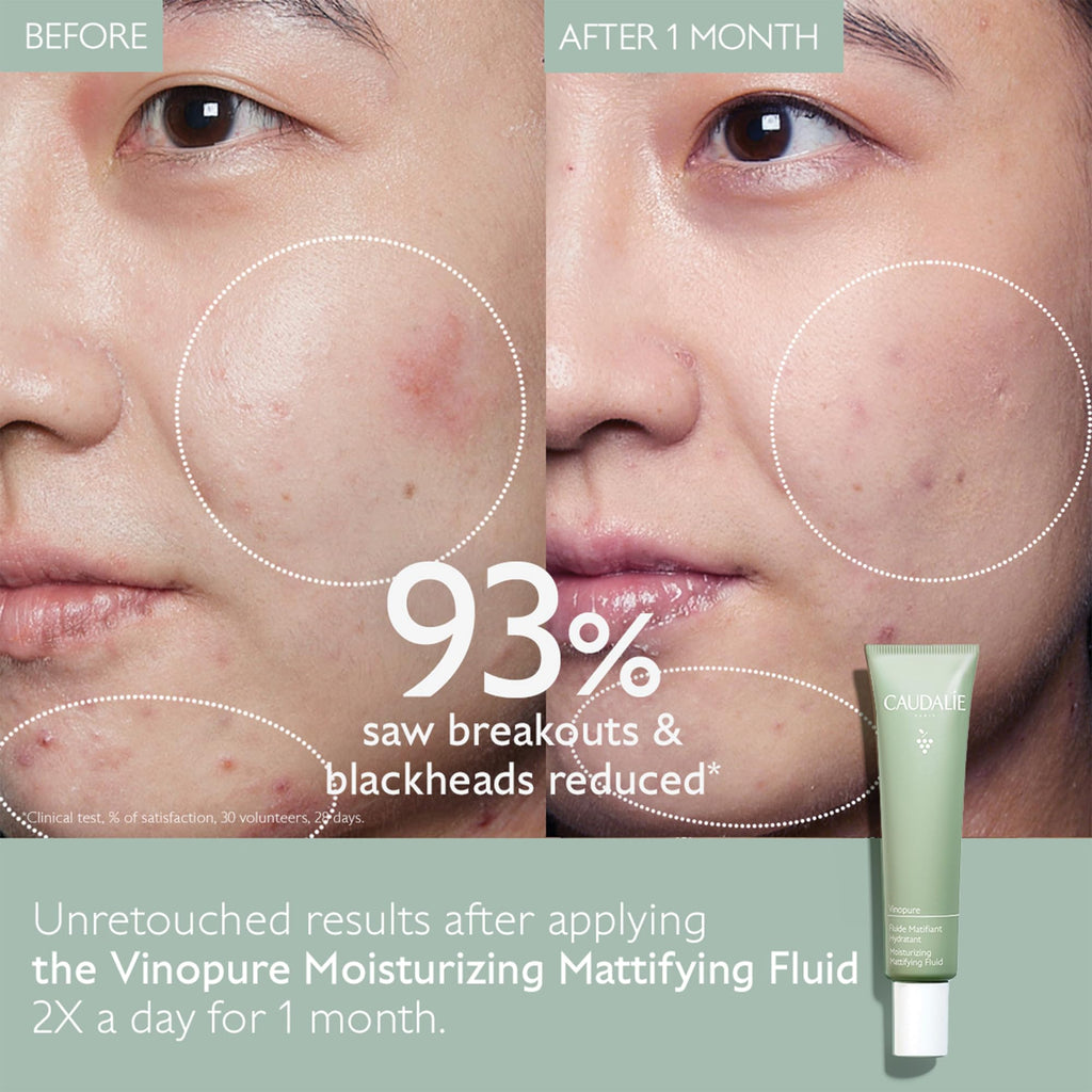 Oil Control Moisturizer 40 mL O354529